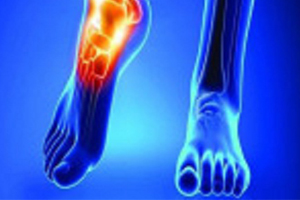 درمان عفونت های استخوانی با سنتز نانوداربست های استخوانی