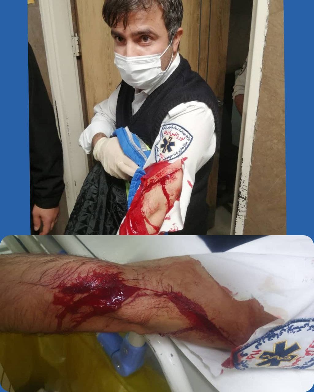 ضرب و شتم و حمله با چاقو به کارشناس اورژانس قزوین